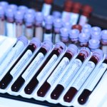 Забор крови на определение беремености