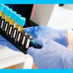 загрузка крови в пробирках для анализов в гематологический анализатор