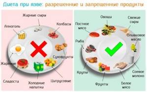 Диета Доктора Язва. Диета при язве желудка: варианты меню