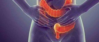 заворот кишок