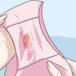 Yellow-green discharge in women after childbirth - All about children