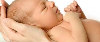 Jaundice in newborns. Causes and consequences, treatment in the maternity hospital and at home