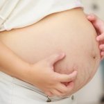 Itchy skin during pregnancy